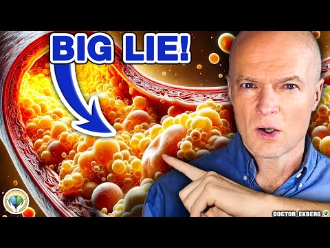 Thumbnail for #1 Most DANGEROUS Cholesterol Lie You Must Know!
