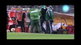 Jugador De Olimpia Se Golpea Con El Banco De Suplente Independiente - Olimpia