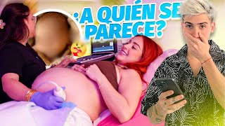 Thumbnail for ASÍ SE VERÁ NUESTRO BEBÉ 😱 Ultrasonido con Inteligencia Artificial