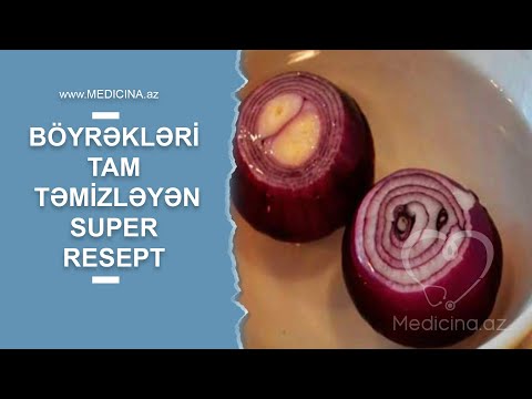 Video: Tikanlı yüksəkliklər əsl hekayədirmi?