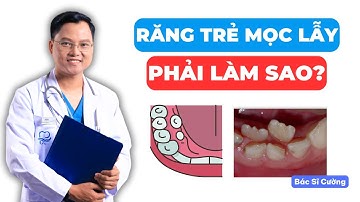 Răng bé bị mọc lẫy phải làm sao??? | Bác sĩ Cường