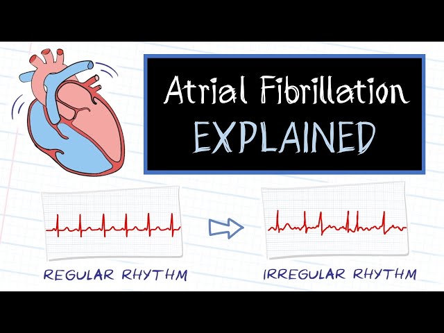 What is Atrial Fibrillation? class=