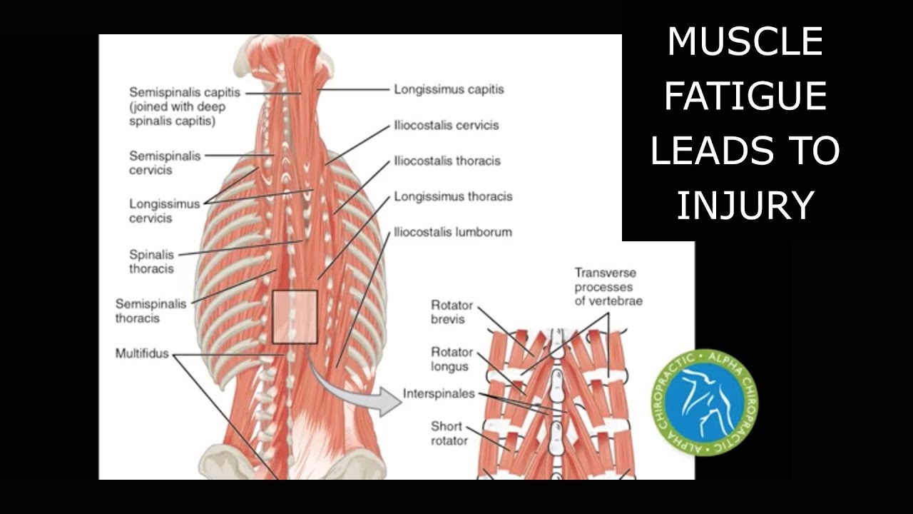 Muscle Fatigue Leads to Injury YouTube