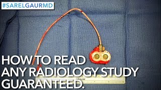 How to Read Any Radiology Study GUARANTEED