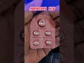#unwantedkit  💯 Using for Abortion...!