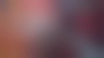 LS1+2a Subsegmentectomy