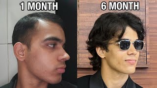 Hair Loss Results Of Using Minoxidil After 6 Months 
