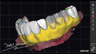 exocad license activation step by step, how to install exocad dentalcad