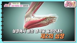 [닥터의 경고] 제2의 심장, 발이 건강해야 장수한다! 발 건강 테스트! [무엇이든 물어보세요] | KBS 240520 방송