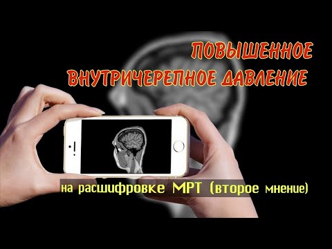 Video: Мээнин ак затындабы?