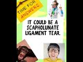 IS MY WRIST PAIN A SCAPHOLUNATE INJURY?