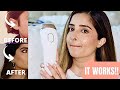 At Home Laser Hair Removal 10 Month Update | DID IT WORK? IS IT WORTH IT?