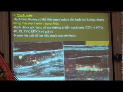 Video SIÊU ÂM HẠCH CỔ (BS. LÊ HỒNG CÚC) - youtube