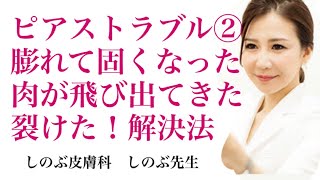 ピアストラブル② 膨れて固くなった、肉が飛び出てきた、ピアスが裂けた、ピアスが埋まった、の解決法。