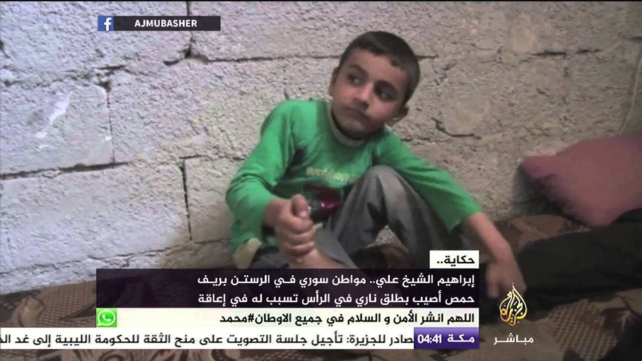 حكاية.. مواطن سوري في الرستن بريف حمص أصيب بطلق ناري في الرأس تسبب بإعاقة له