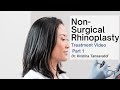 Dr. Kristina Tansavatdi | Non-Surgical Rhinoplasty | Part 1 of 2