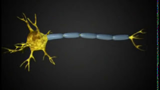 Myelin sheath is destroyed: Multiple Sclerosis