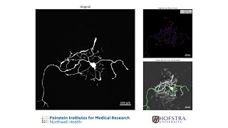 Download Lagu Development of a Novel Automated Computational Tool for Neurite Analysis (2025) MP3