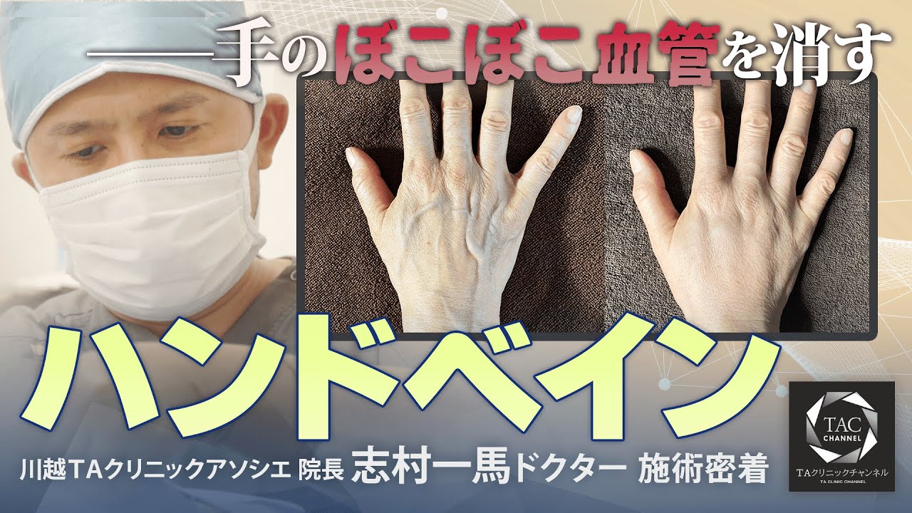 こめかみ 血管脈打つ | こめかみ 血管 浮き出る なぜ – NSTIXA