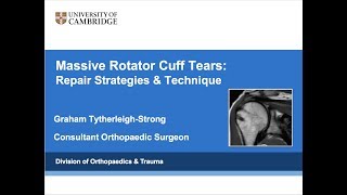 Massive Rotator Cuff Tears: Repair Strategies & Technique