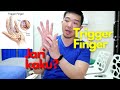 Trigger finger & jari kaku 🖐🏻: Sembuhin sendiri dengan cara mudah!