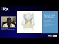 The new Evolut PRO+ system: optimal procedural outcomes in all patients - EuroPCR 2021