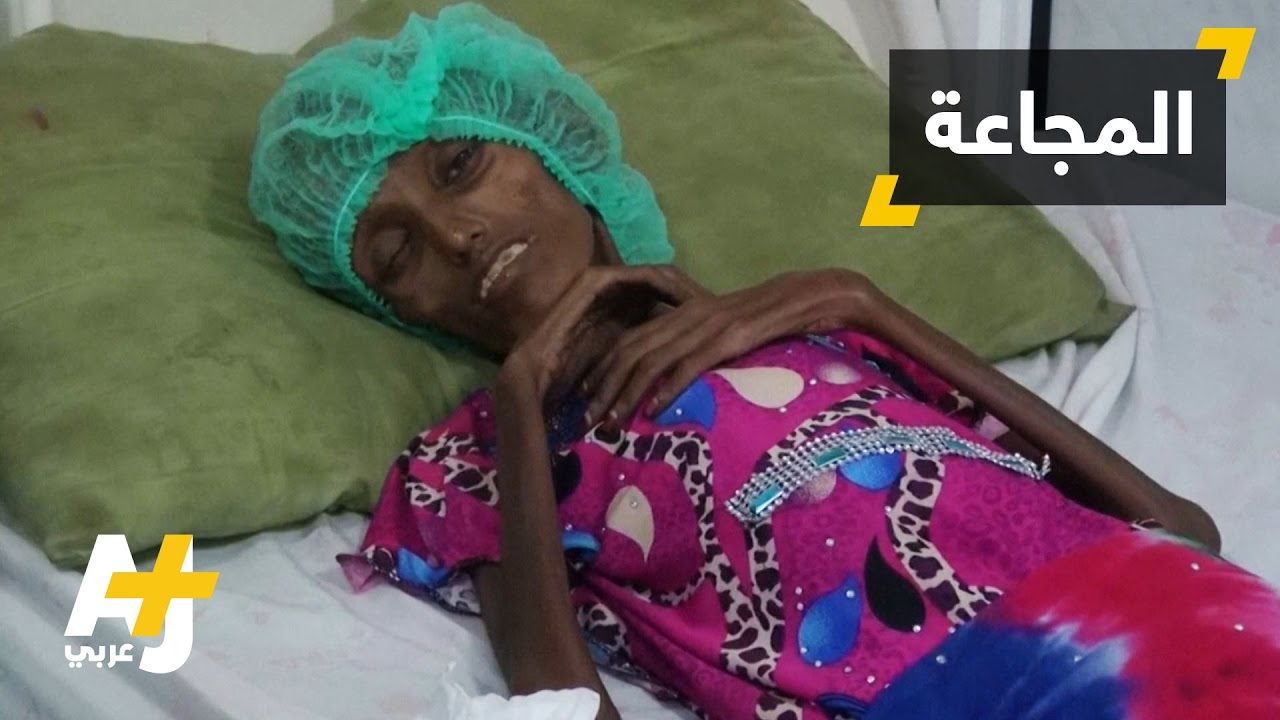 هل اليمن مقبل على مجاعة؟