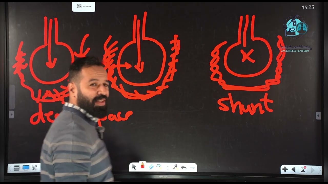 شرح محاضرة البكج الوزاري للعناية المركزة/للمرحلة الثالثة/part1/ARDS