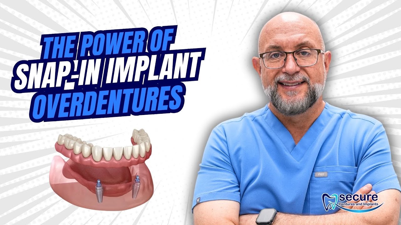 The Power of Snap-In Implant Overdentures - Dr. McConnell from Secure Dentures and Implants