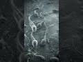 sperm birth to death #anatomy #sperm