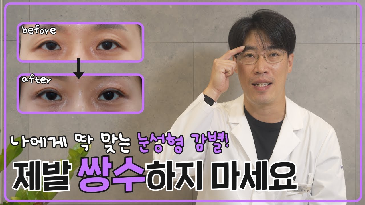 쌍수 전 필수 이런분들은 쌍꺼풀 수술 하지 마세요 / 내 눈에 딱 맞는 눈성형 - YouTube