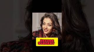 Aishwarya Rai Bachchan Before Surgery After Surgery 