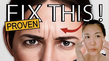 Proven Routine to Remove 11 Lines Without Botox