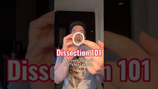 What’s a vertebral artery dissection