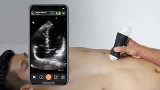 Cardiac Apical 4 Chamber View - Ultrasound Scanning Technique
