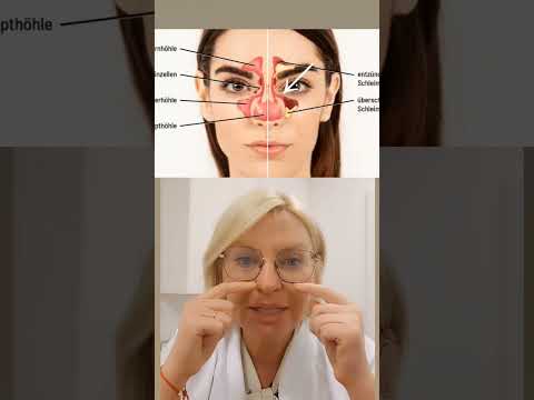 носовые пазухи,  как это происходит и что с этим делать