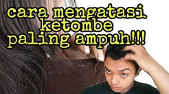 Cara mengatasi / menghilangkan ketombe paling ampuh | cerita pengalaman saya - Durasi: 8.28. 
