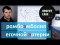 Все о ТЭЛА - тромбоэмболия легочной артерии