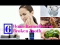 Effective Natural Remedies for Broken Tooth Pain | Oral Health Tips