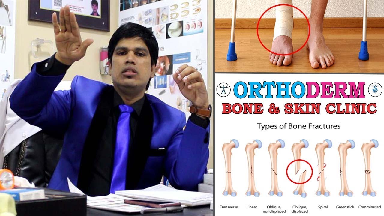 How to handle fractured bone #2 |  Dr.S.Chinna Durai | Orthoderm Skin & Bone Clinic | Doctors On