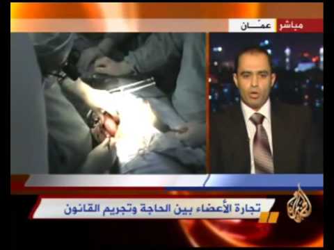 تجارة الأعضاء .. بين الحاجة وتجريم القانون
