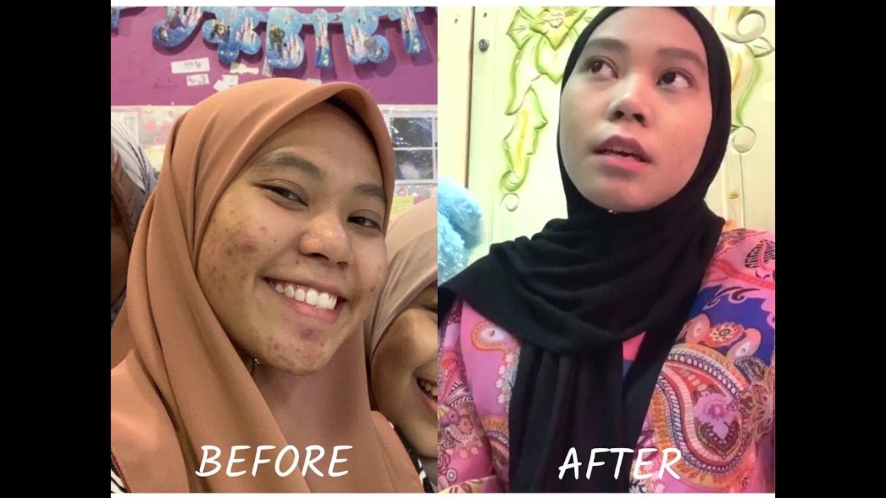  WANITA  DIEJEK MUKA MACAM  JALAN TAR YouTube