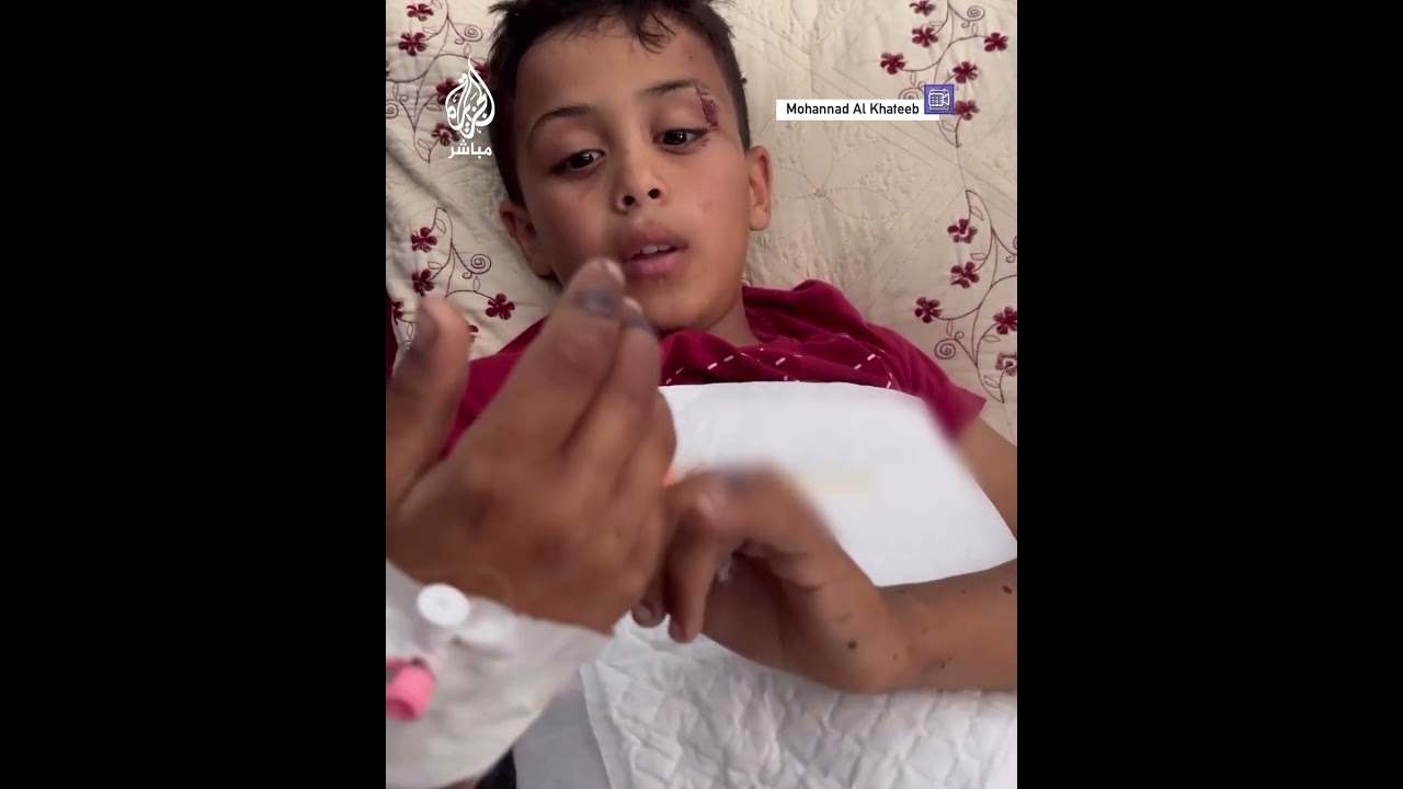 الطفل ياسين الغلبان فقد ساقيه بسبب قصـ ـف الاحتـلال