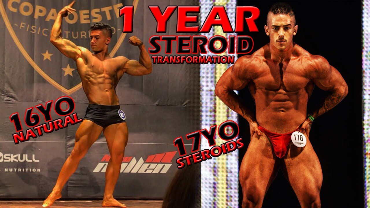 1 Year STEROIDS Transformation | 16yo - 17yo | On Stage