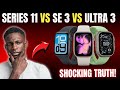Apple Watch Series 11 vs SE 3 vs Ultra 3 – Which One Should You Buy?