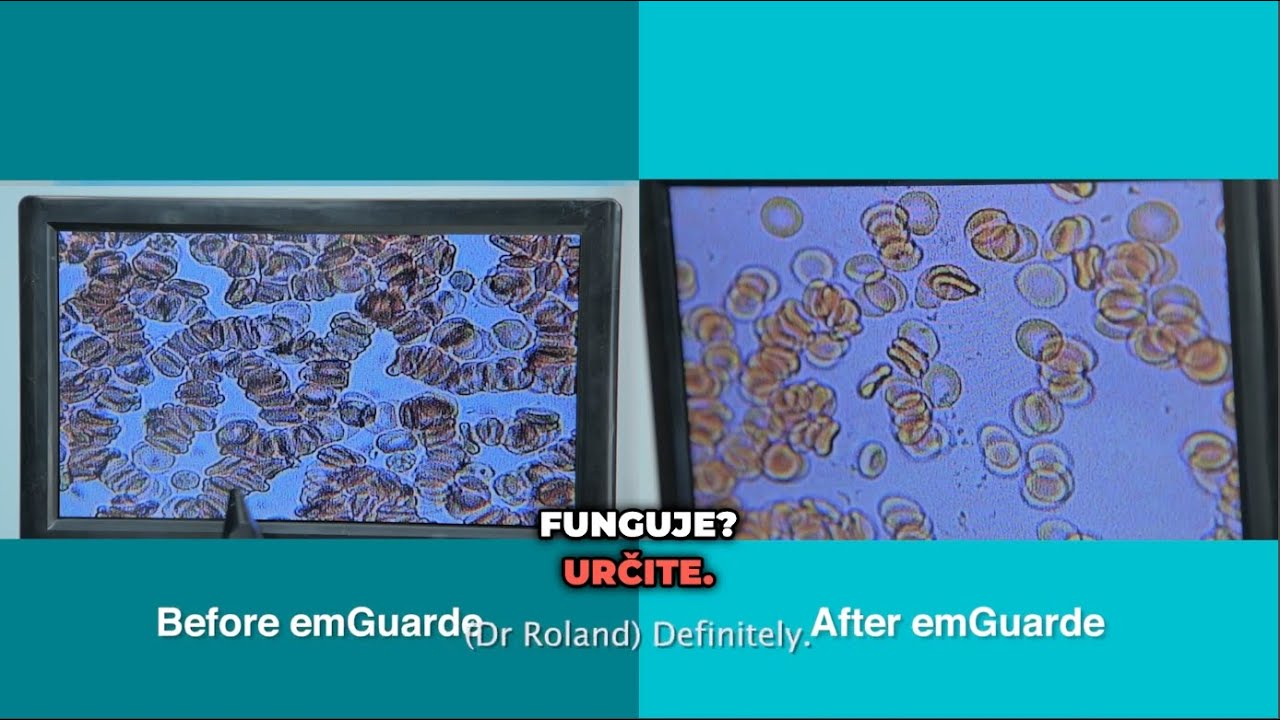 EMR Exposed  Dr. Roland odhaľuje zdravotné riziká a ochranu s emGuarde prevzaté video s dabingom