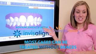 Invisalign 2017