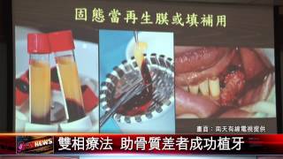 20150707 雙相療法 助骨質差者成功植牙