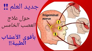 تشخيص وعلاج العصب الخامس بأقوى الأعشاب الطبية الآمنة!!!