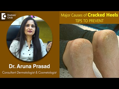 Dry, cracked heels are caused by chronic friction and pressure. Shoes ... |  kerasal intensive repair | TikTok
